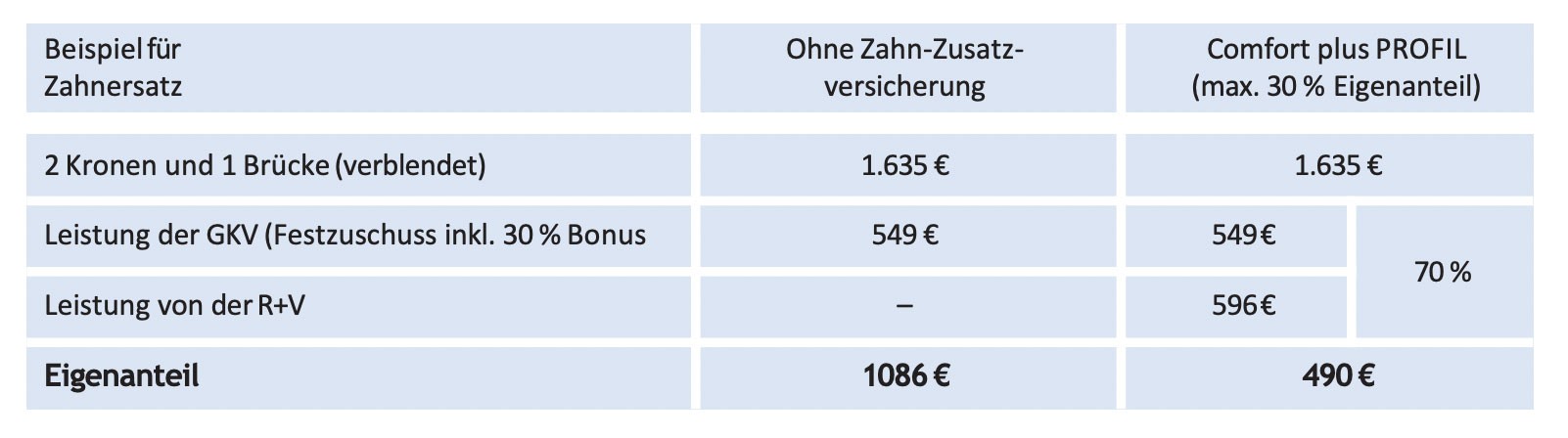 tabelle-zahnersatz